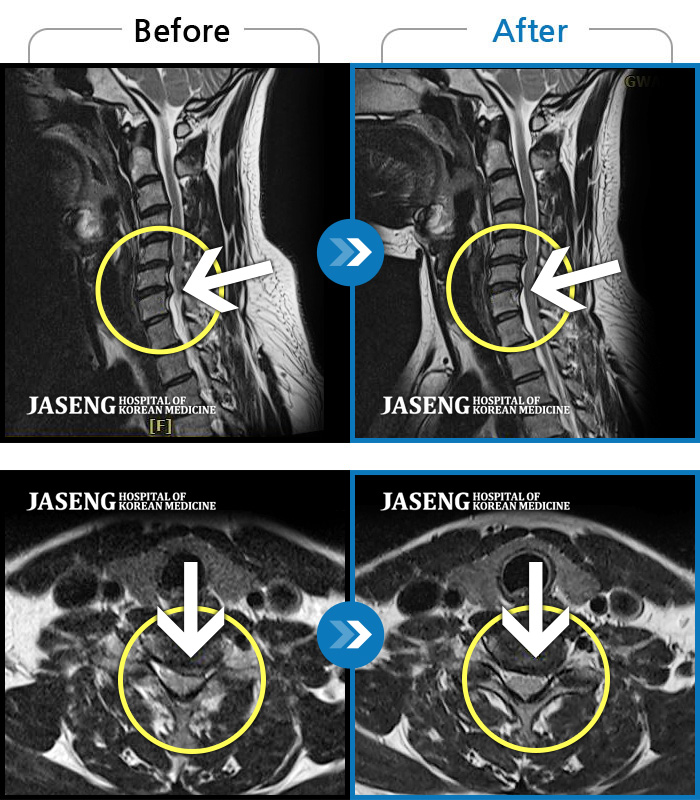 ڻѹ溴 ġ MRI  ġ-   հ   ÿ    ȣϿ ϼ̽ϴ.