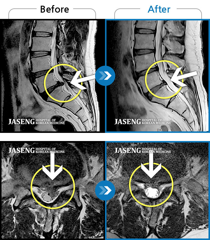 ڻѹ溴 ġ MRI  ġ- ڼ   ġ, , Ƹ ĸ, , ߰   . 