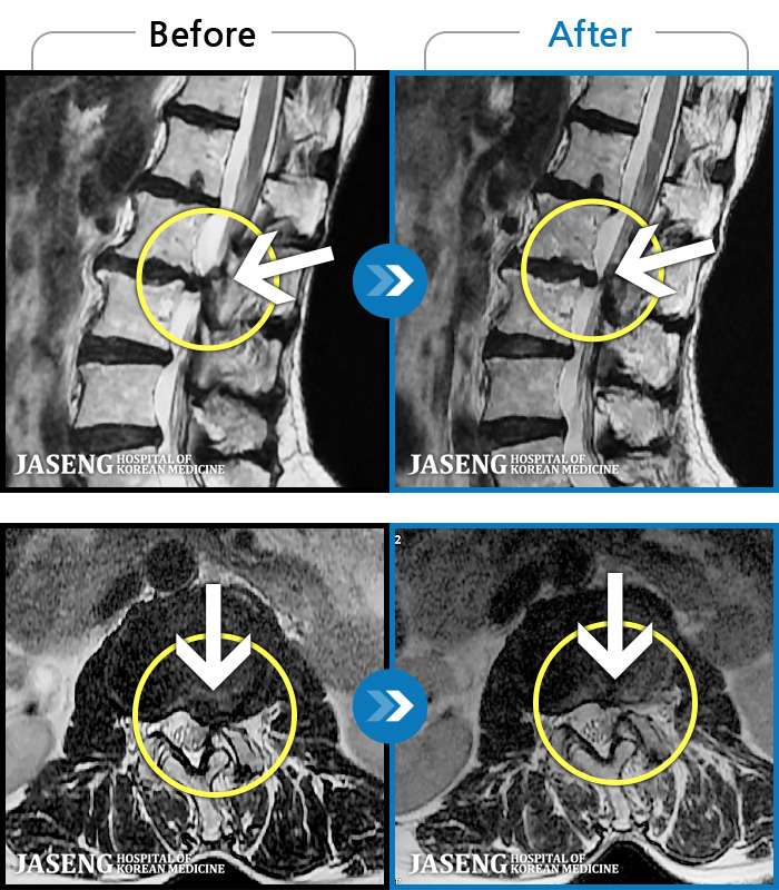 ؿڻѹ溴 ġ MRI  ġ-㸮 ϰ    