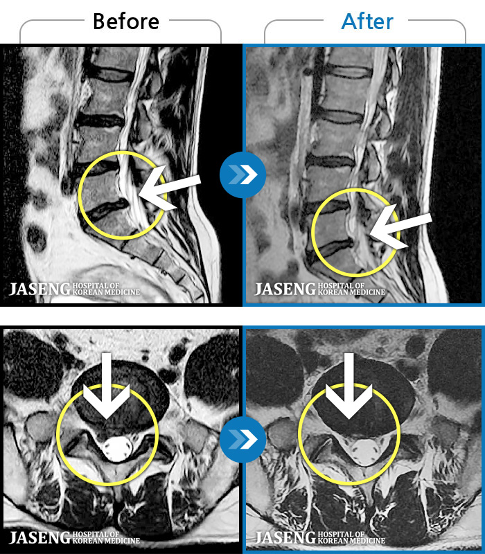 ڻѹ溴 ġ MRI  ġ- ݺ   ӵǸ ڼ ÿ   ȭǴ ߵ ̻  ȣϴ ¿ϴ.
