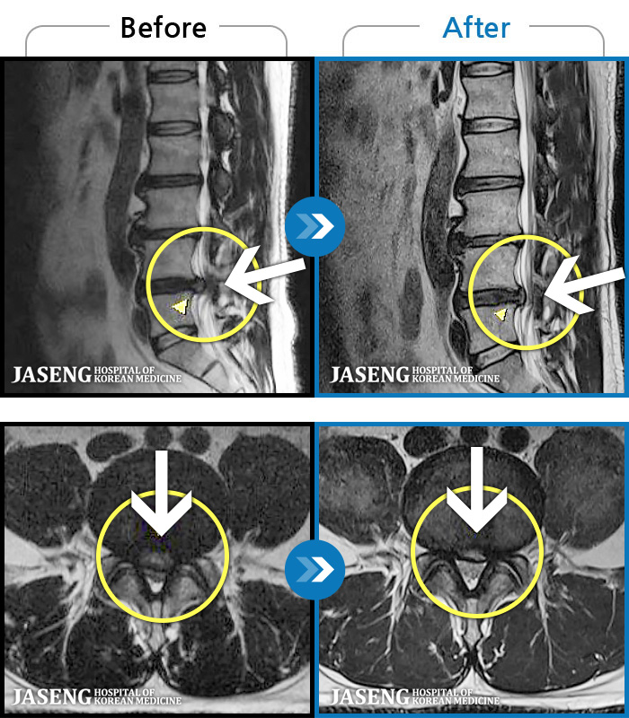 ڻǿ ġ MRI  ġ-㸮  ϰ  ,   ̾   ϼ̽ϴ.