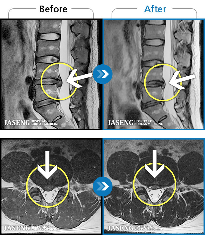 ڻѹ溴 ġ MRI  ġ- 㸮  