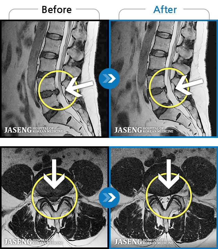 �ڻ��ѹ溴�� ġ���� MRI�� ���� ġ����-���� �㸮���� ��ġ���� ������, �ٸ� ������ ���������� ���ϰ� ��������. 