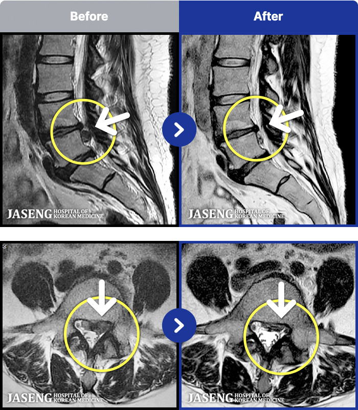 õ���ڻ��ѹ溴�� ġ���� MRI�� ���� ġ����-�ؽ��� �㸮 ������  ���� ��� ��������� �� ���� �����߰��� �ٷ�����