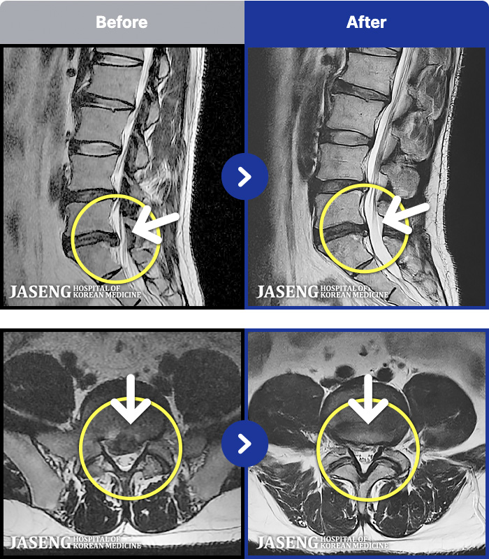 ڻѹ溴 ġ MRI ġ-ؿ ü ް ȭ ȥ ȴ° .