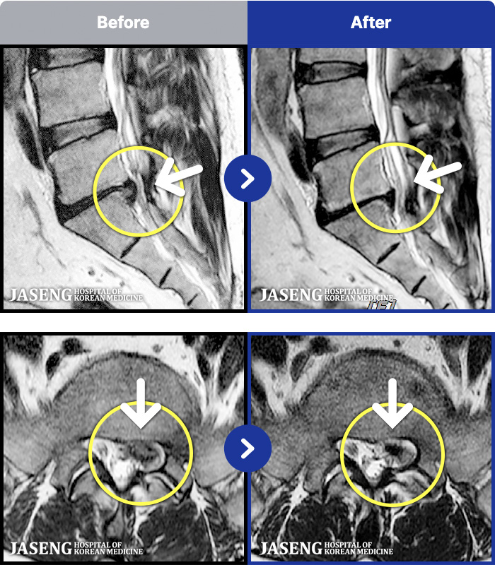 �ڻ��ѹ溴�� ġ���� MRI�� ���� ġ����-�׻� ��ũ�� �����Ͽ����ϴ�.