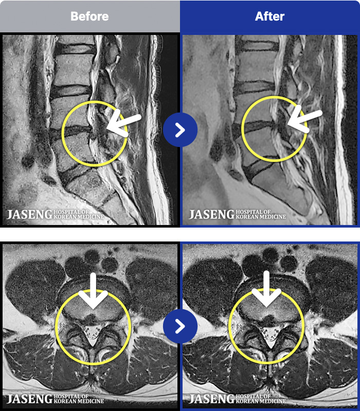 �����ڻ����ǿ� ġ���� MRI�� ���� ġ����-���� ��� ������ ���ϰ� ���� ������ ���� �� ������ ���ӵǸ� ���� ������ �ٷ� �� ���� ����