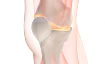 대전자생한방병원 무릎질환 무릎점액낭염-무릎점액낭염 관련 사진 입니다.