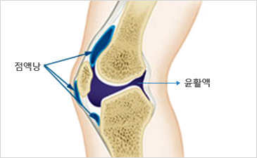 대전자생한방병원 무릎질환 무릎점액낭염-점액낭과 윤활액이 위치해 있는 무릎 설명 이미지