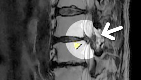 MRI  5