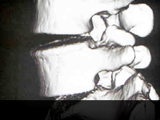 대전자생한방병원 허리질환 퇴행성디스크-정상척추에 관련된 이미지 입니다.