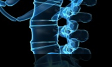 대전자생한방병원 허리질환 척추전방전위증-정상적인 사람의 척추뼈 모습입니다.