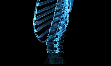 대전자생한방병원 허리질환 척추전만증-정상적인 사람의 척추 모습입니다.
