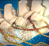대전자생한방병원 허리치료법 신경근회복술-신경근회복술의 특징 네번째 관련 사진 입니다.